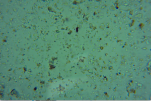 2019- early soils view