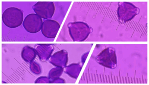 Figure displaying photos of different pollens on slides