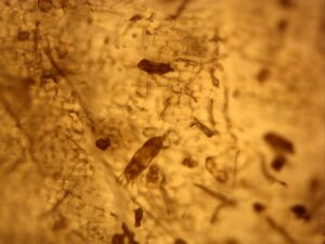 Microscope photo of mites on garlic