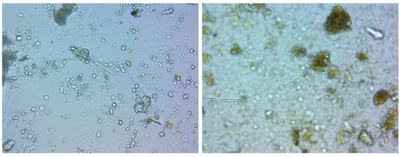 Figure 4 - Microscopic view of hyphae identified as oomycetes in IMO